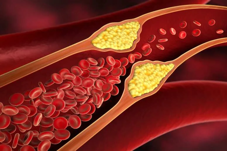 Co to jest cholesterol? 