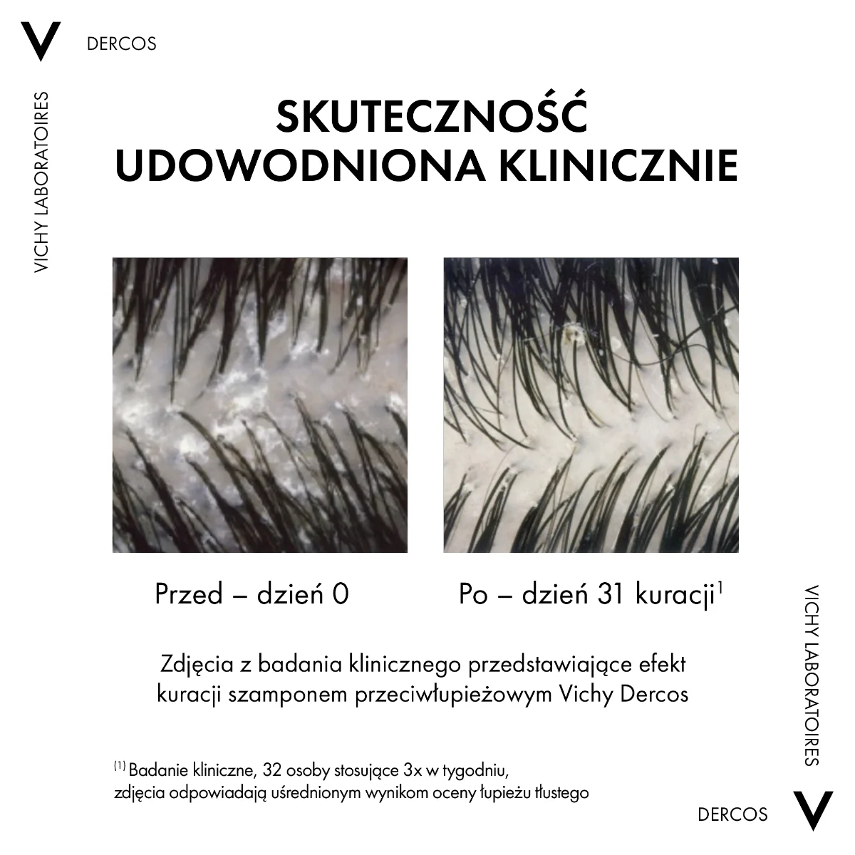 Vichy Dercos szampon przeciwłupieżowy, 200 ml