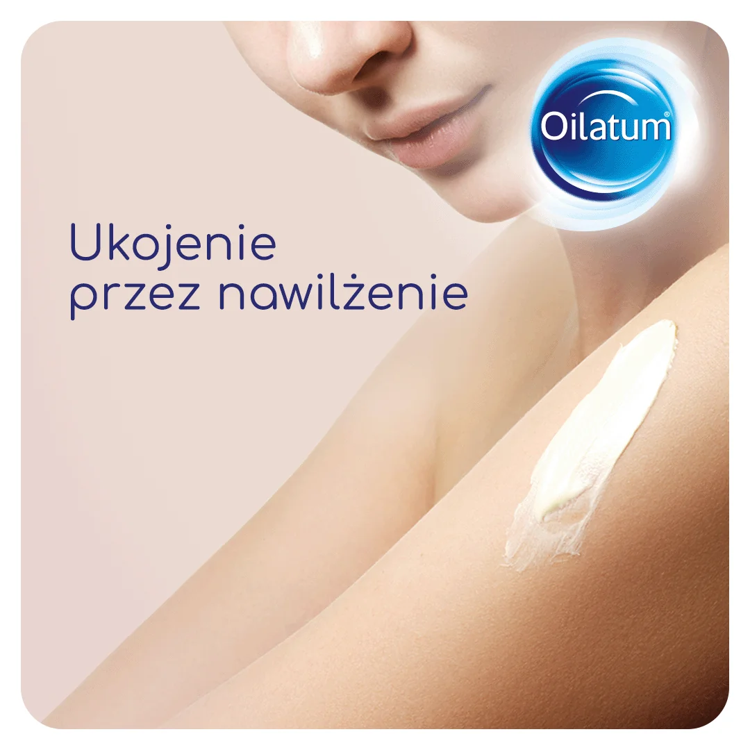 Oilatum Formuła MED krem do skóry suchej, 300 ml