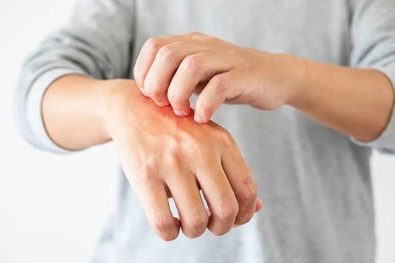 Stan zapalny skóry – przyczyny, objawy i leczenie