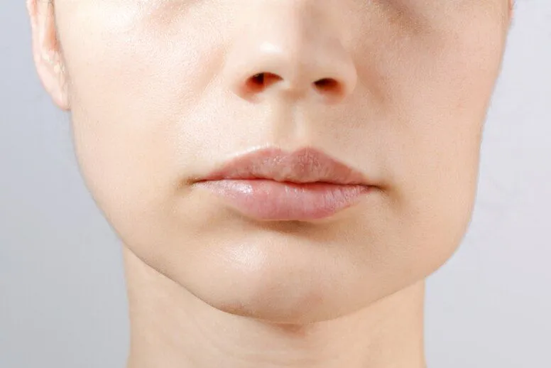 Opuchnięta twarz – o czym może świadczyć i jak zlikwidować obrzęk twarzy?
