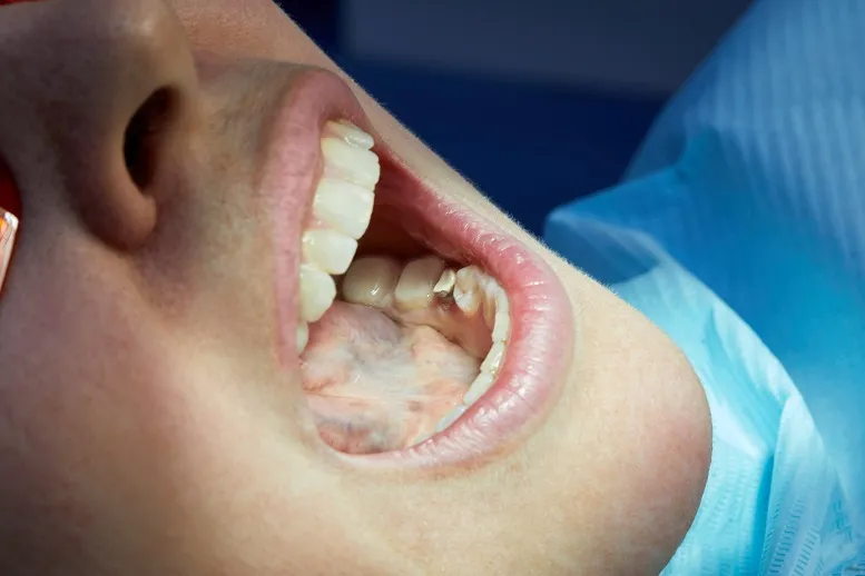 przeciwwskazania do piaskowania zębów