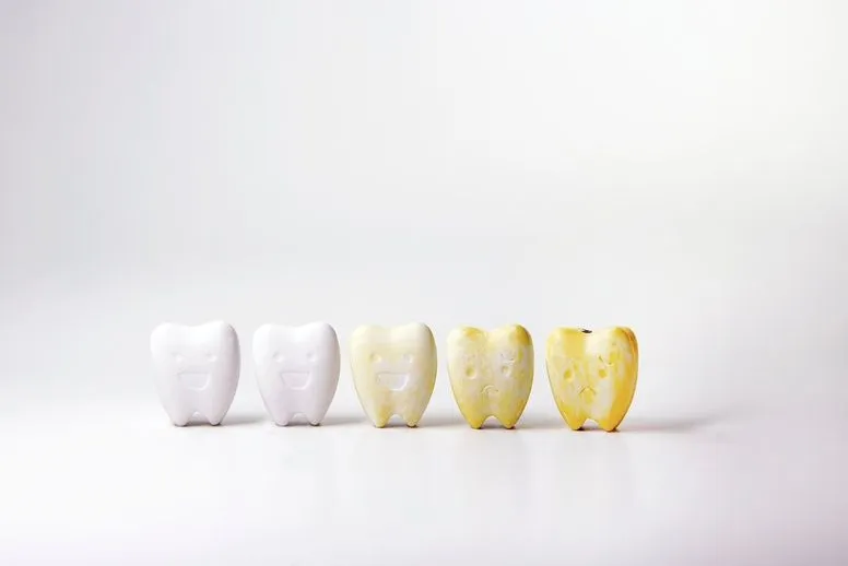 Przebarwienia na zębach – jak powstają i jak im zaradzić?