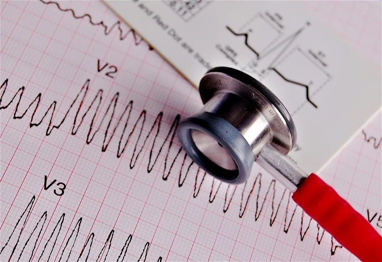 Częstoskurcz komorowy. Jakie objawy daje przyspieszone bicie serca?