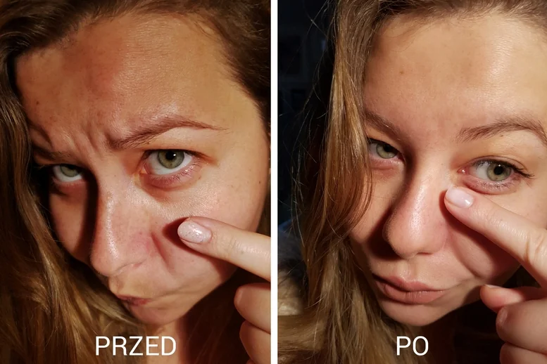 serum na przebarwienia Nuxe Splendieuse efekty przed i po