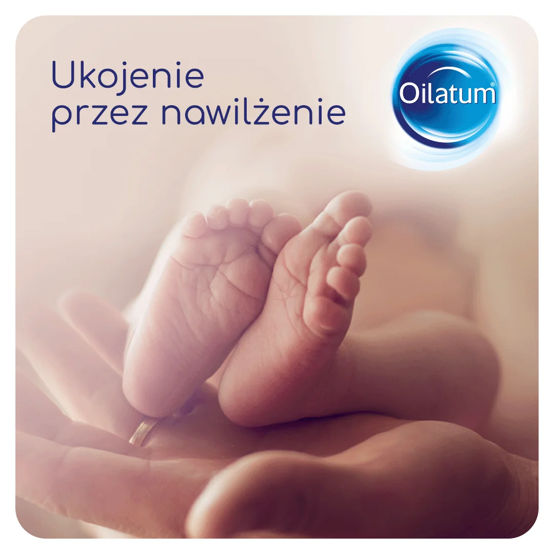 Oilatum Formuła Zaawansowana Emulsja do kąpieli skóra bardzo sucha, podrażniona, swędząca, 250 ml