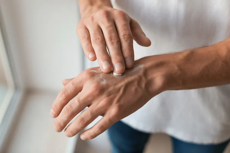 pielęgnacja skóry dłoni