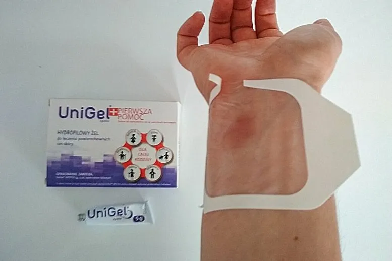 opatrunek na oparzoną rękę z UniGel
