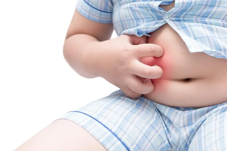 Wysypka na brzuchu u dziecka: objawy, przyczyny i sposoby leczenia